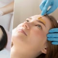 Post-Treatment Care for Facial Waxes